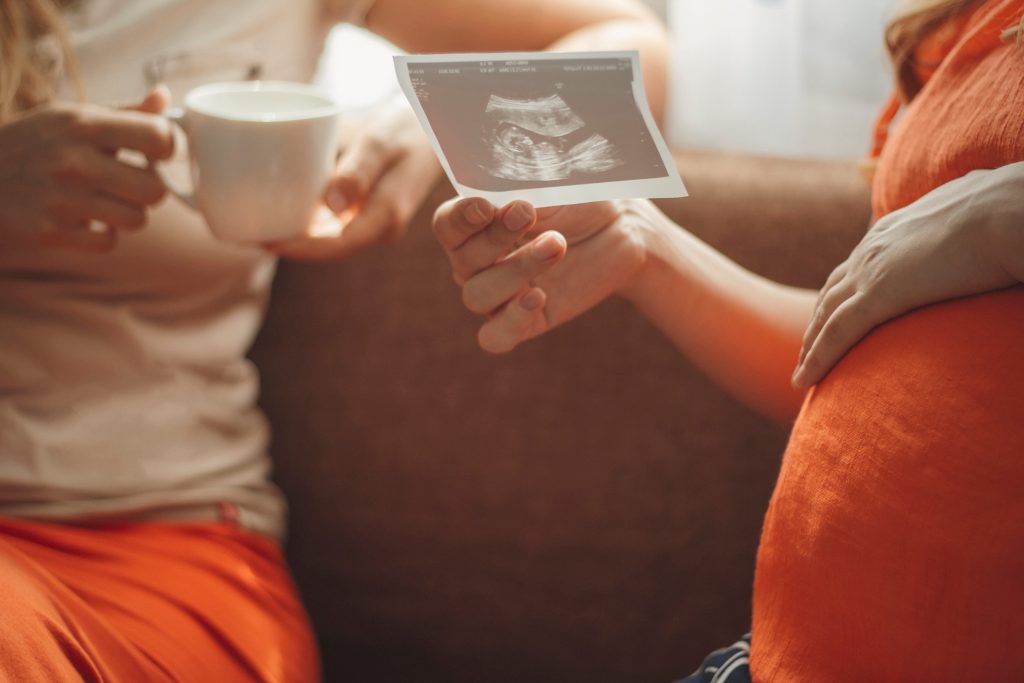 Pregnant,Young,Woman,Sitting,In,Kitchen,With,Girlfriend,Showing,Photo